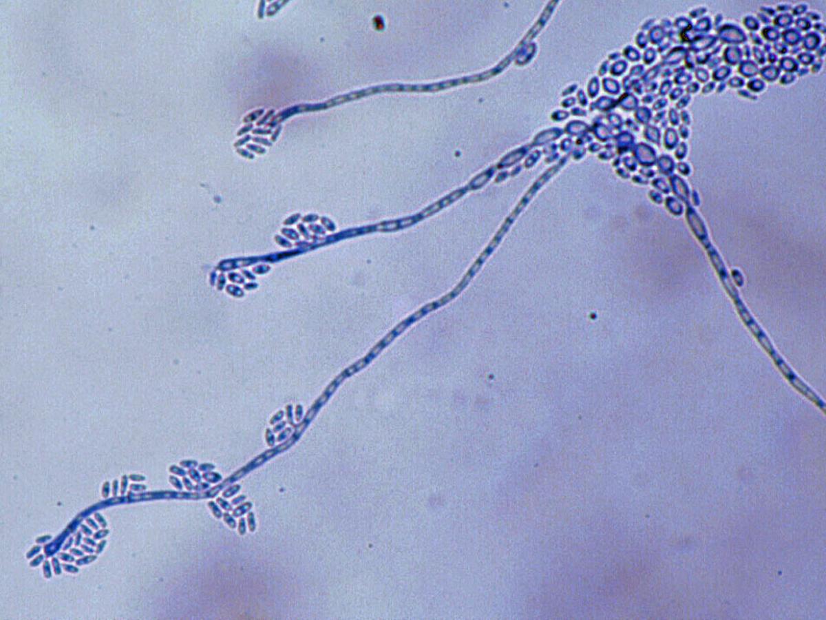Unknown 16 microscopy - 1