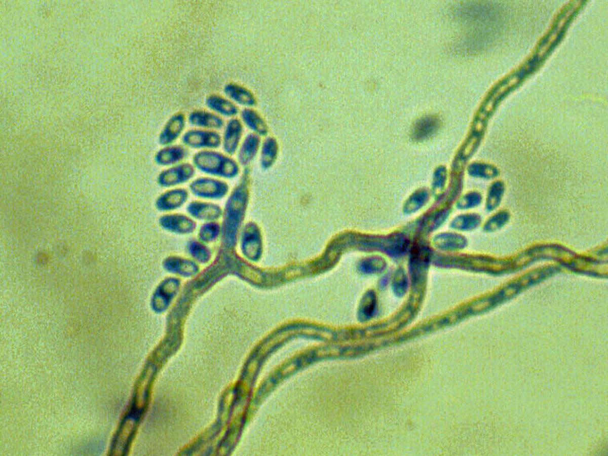 Unknown 16 microscopy - 2