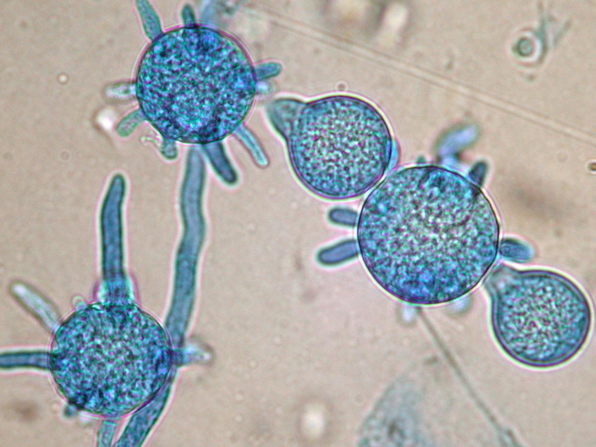 Unknown 19 microscopy - 1