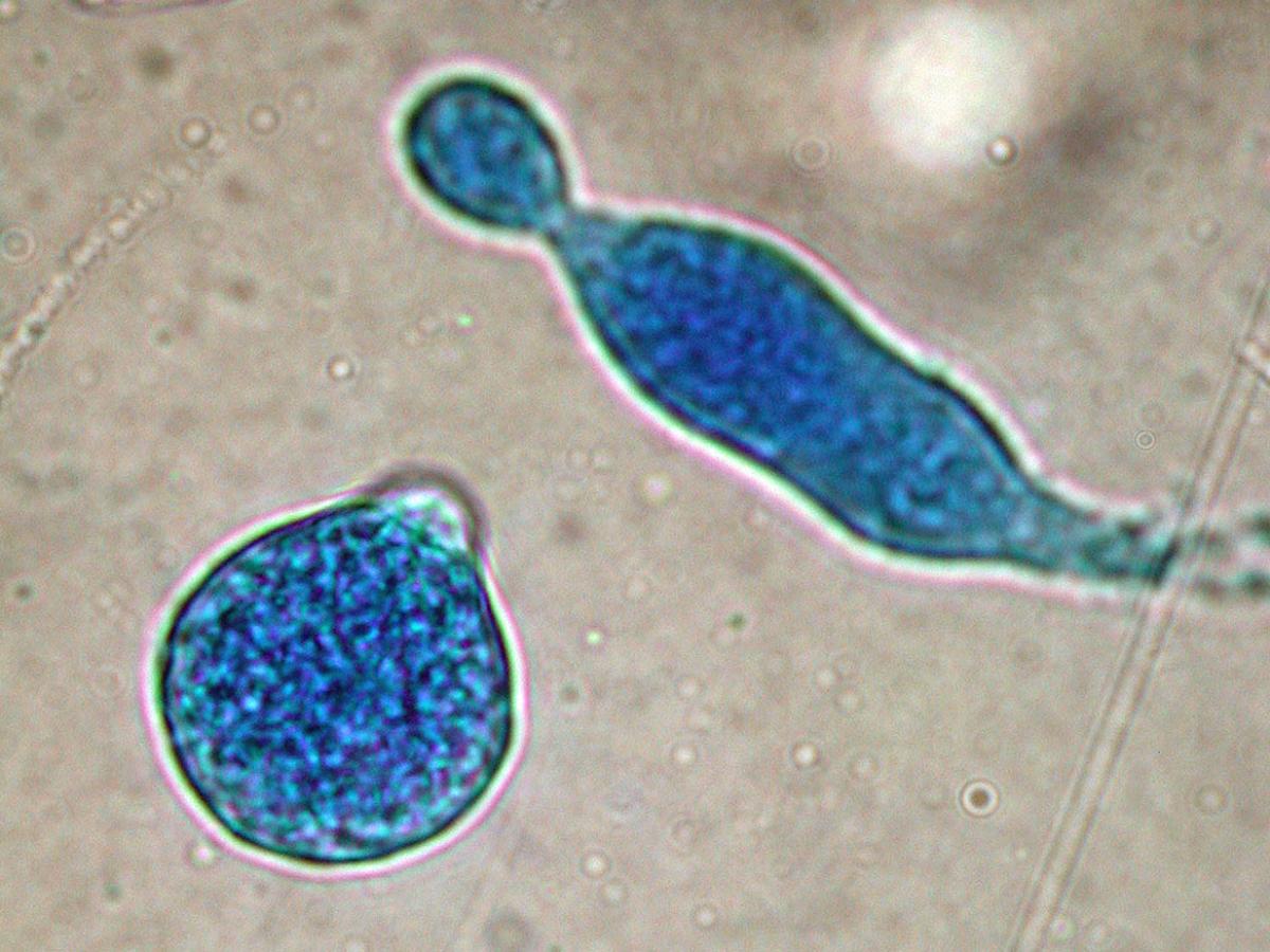 Microscopy