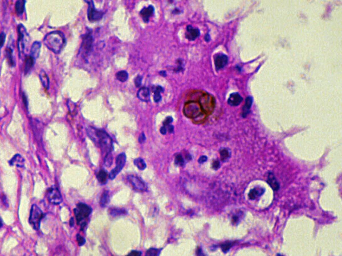 Histopathology