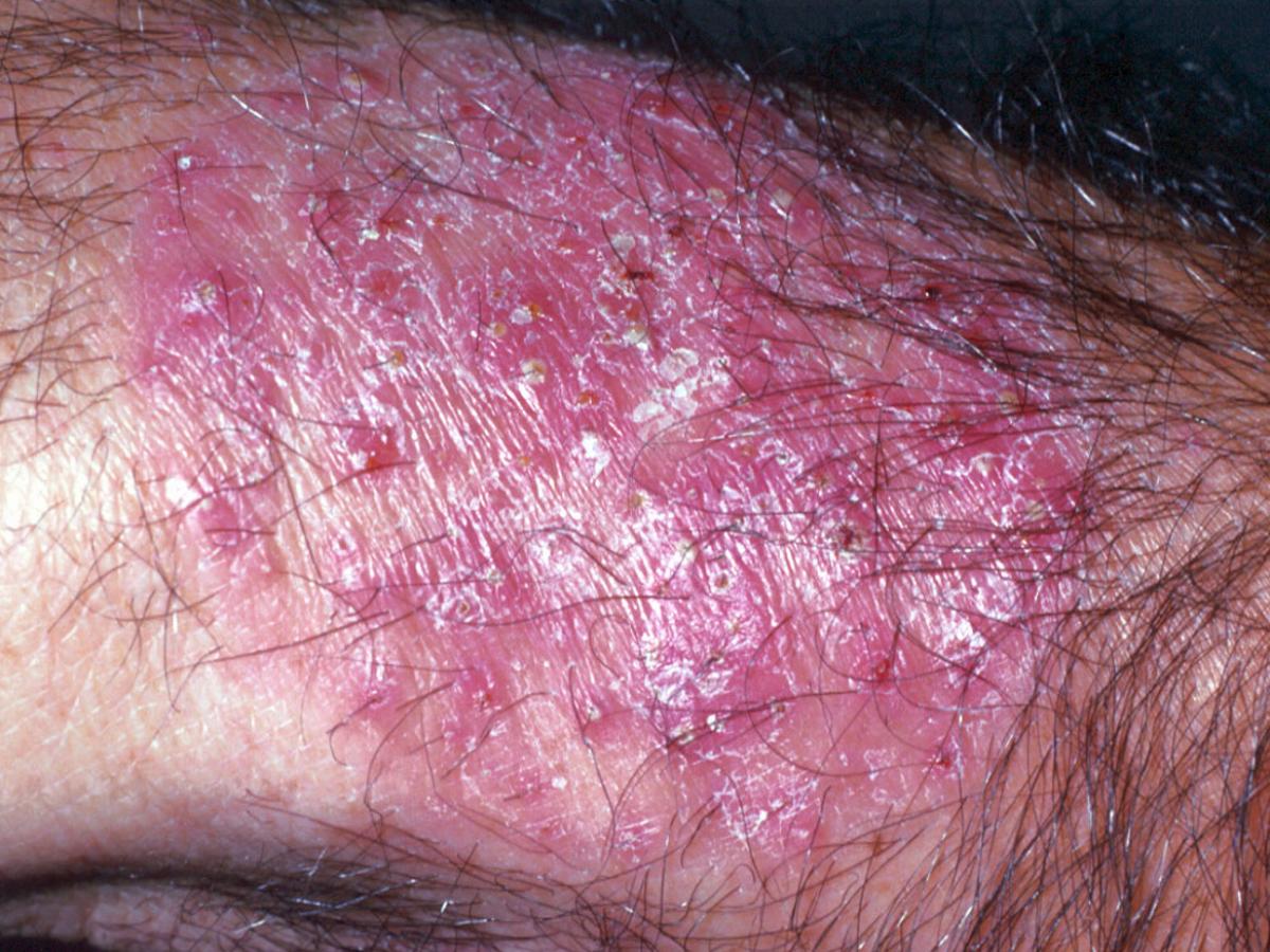 Unknown 21 clinical presentation