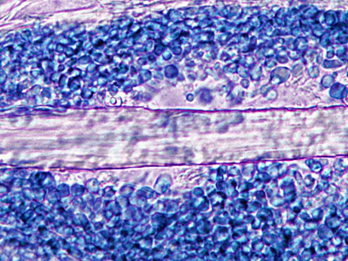 Unknown 21 direct microscopy