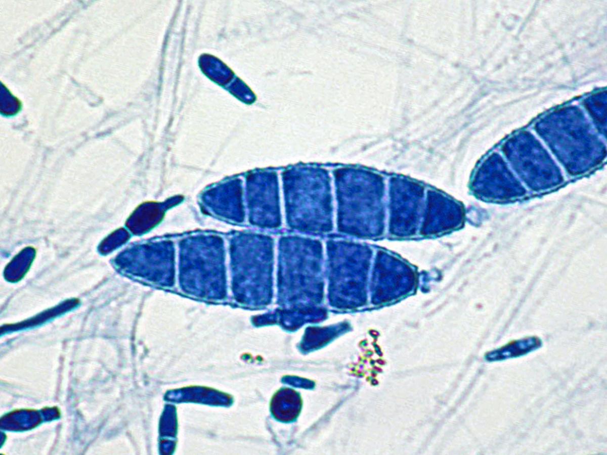 Unknown 21 microscopy