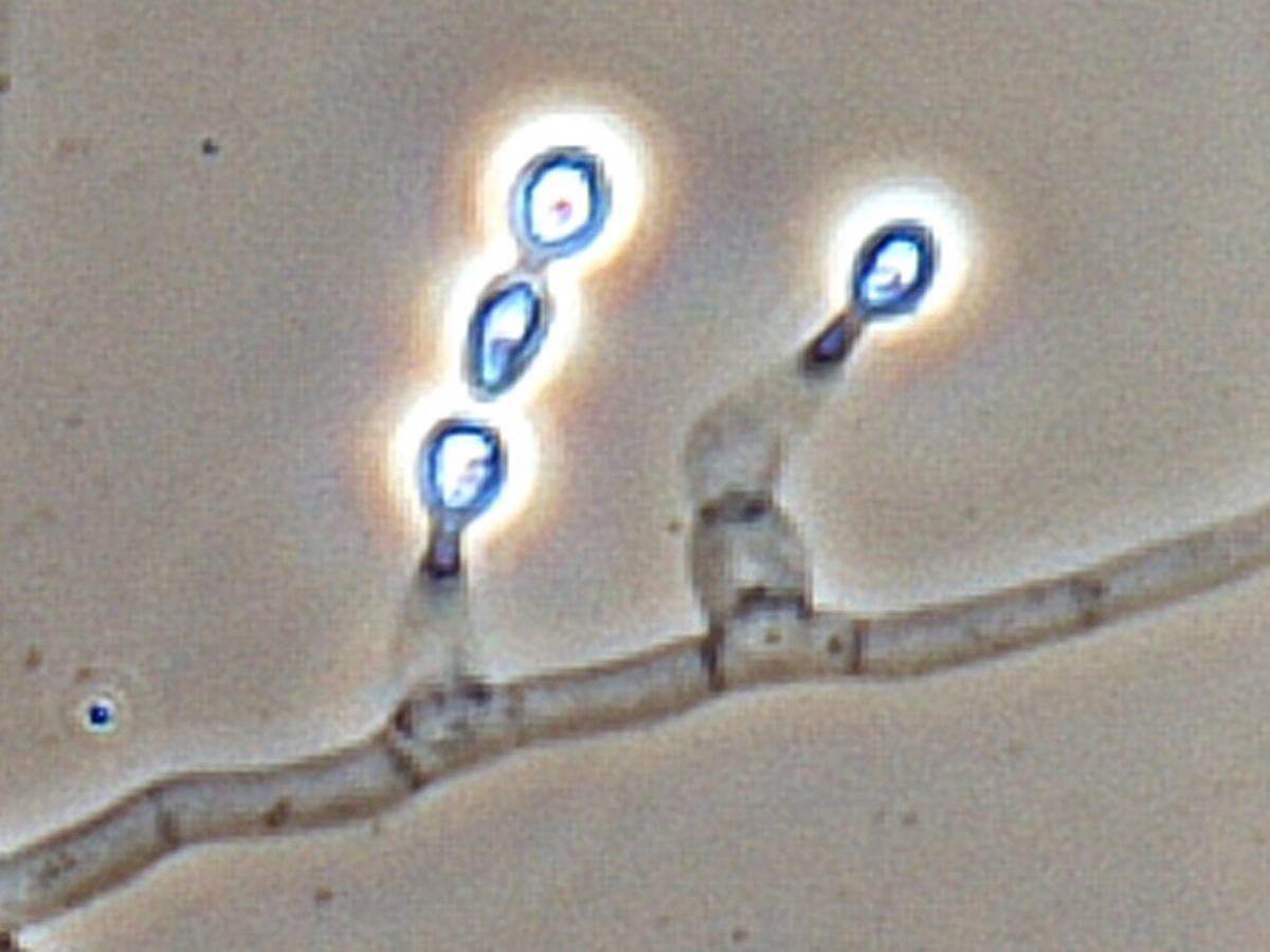 Unknown 25 microscopy - 2