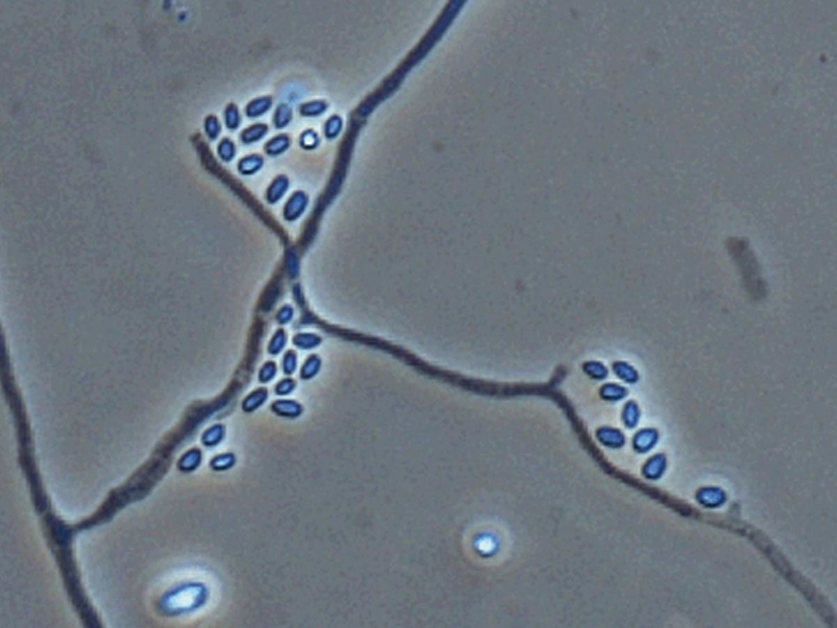 Unknown 28 microscopy - 2