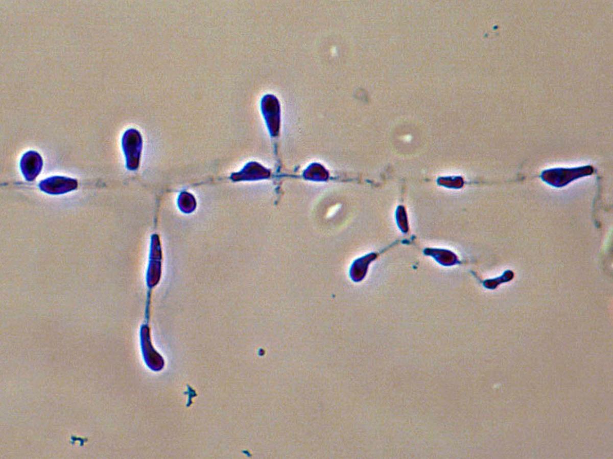 Unknown 31 microscopy - 1
