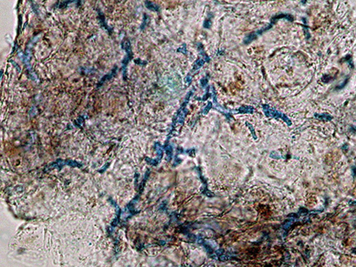 Direct microscopy
