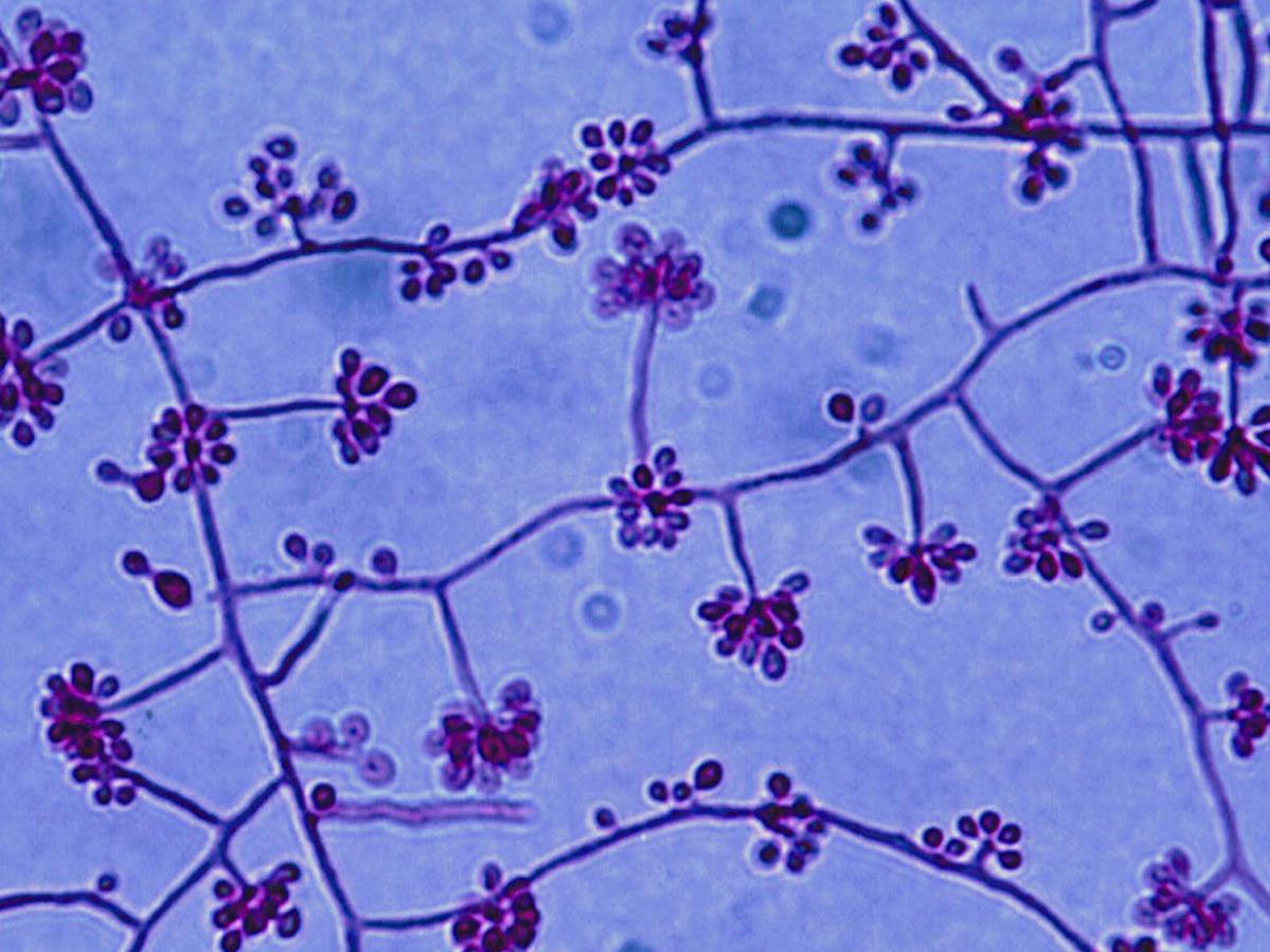 Unknown 33 microscopy