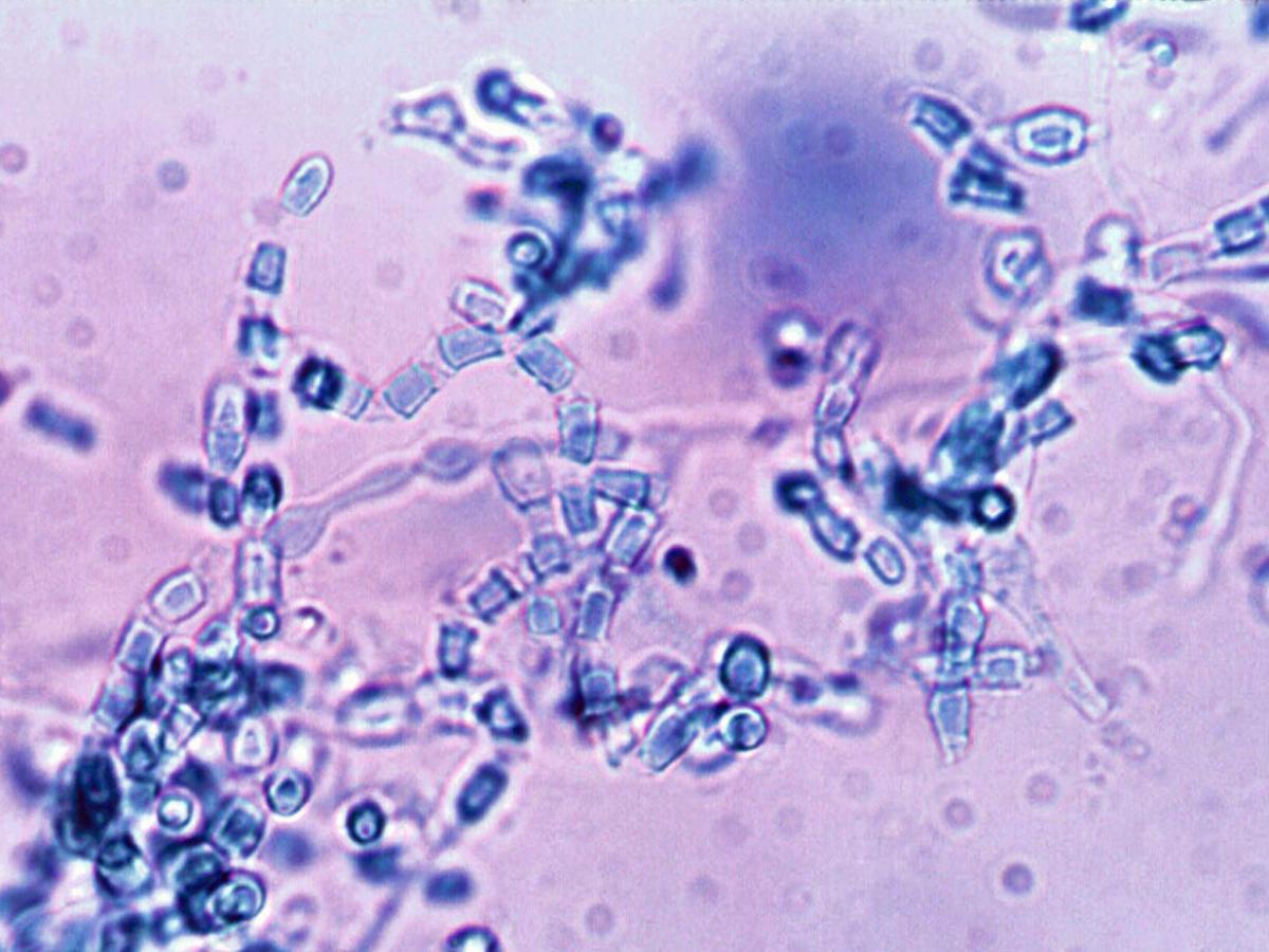 Microscopy