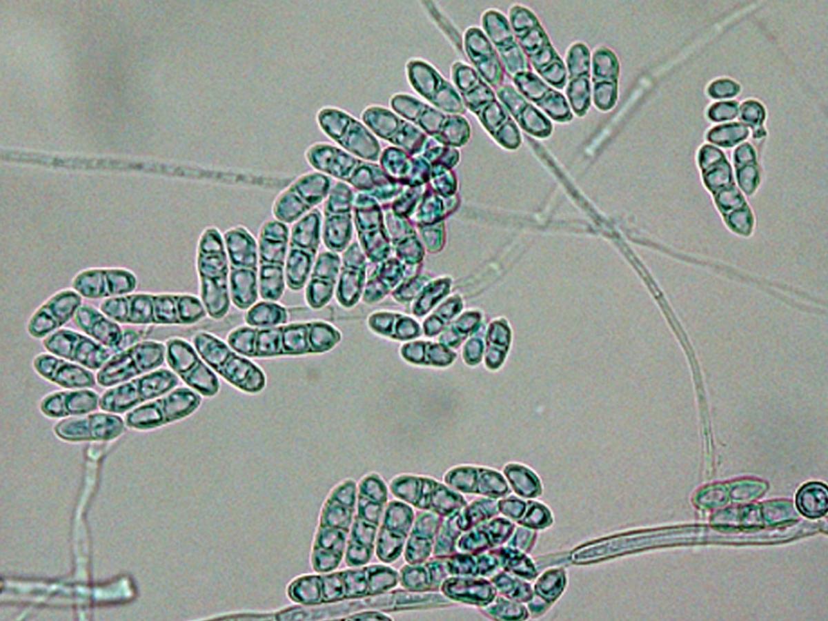 Unknown 35 microscopy - 1