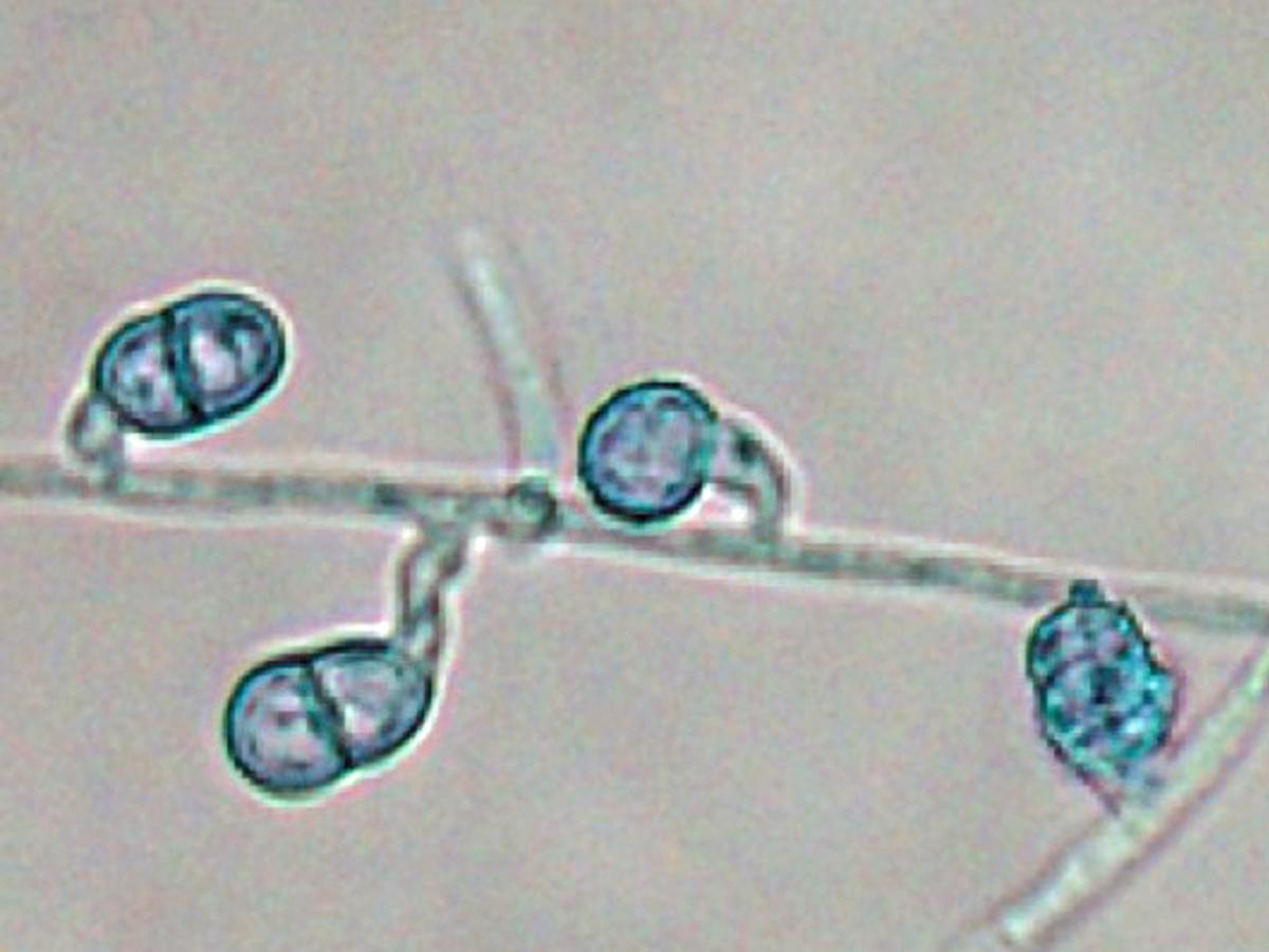 Unknown 35 microscopy - 2