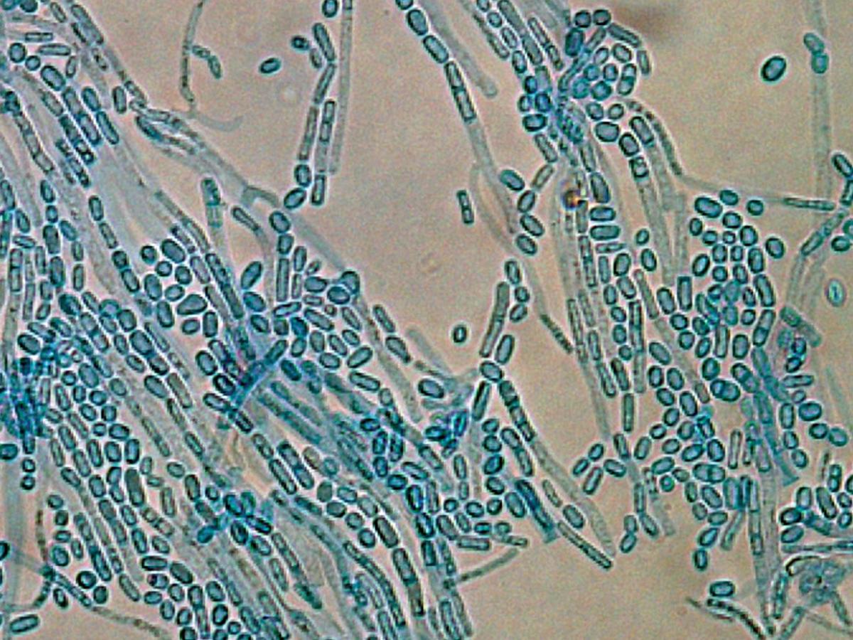 Microscopy
