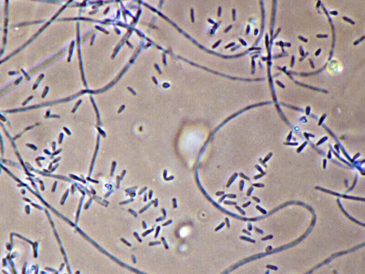Unknown 38 microscopy - 2
