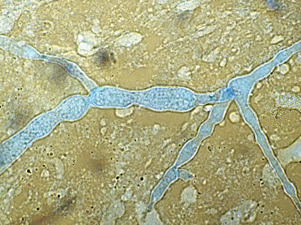 Unknown 40 direct microscopy