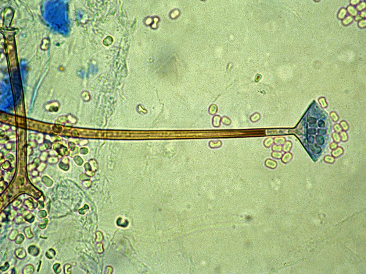 Unknown 40 microscopy