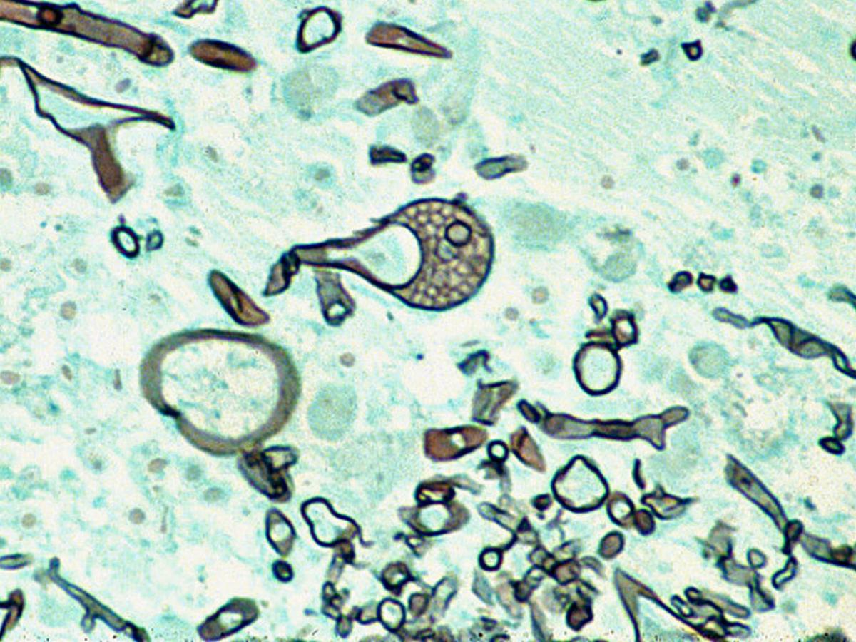 Histopathology