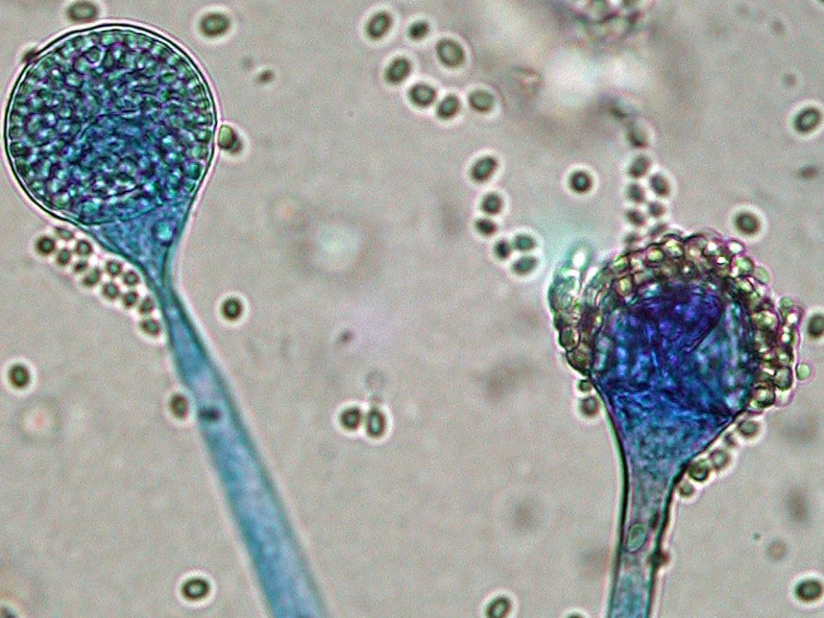 Microscopy