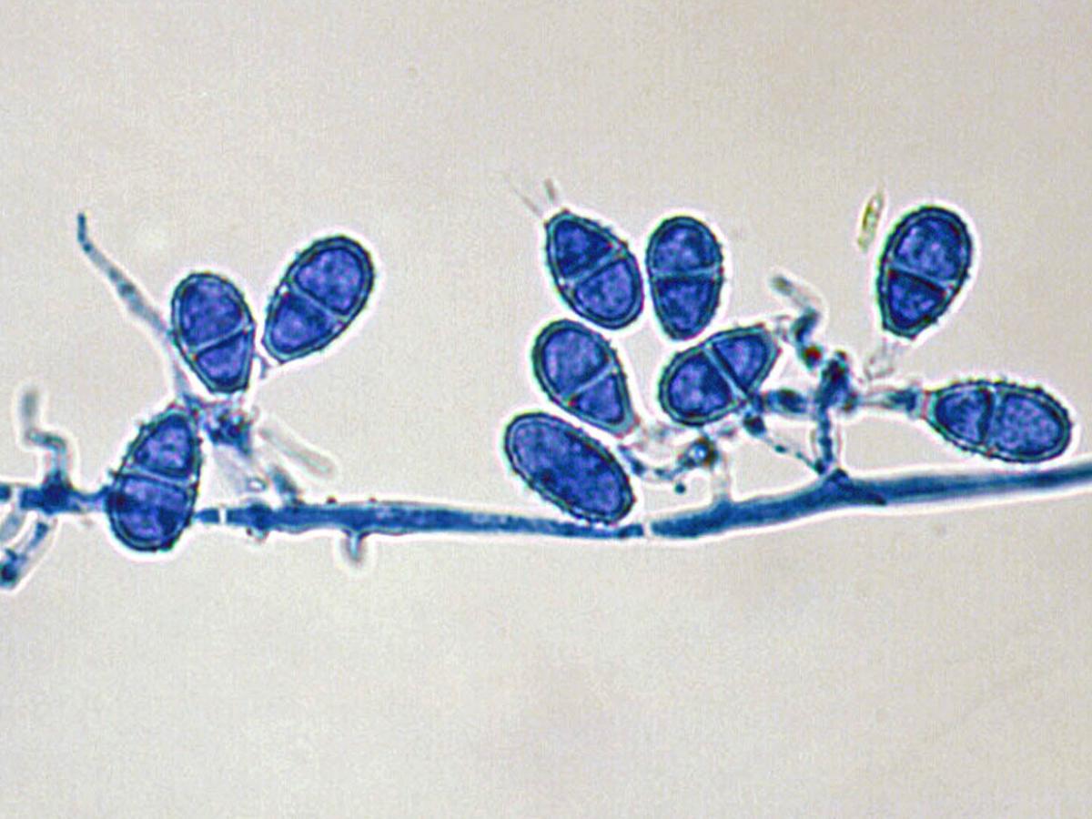 Unknown 47 microscopy - 1