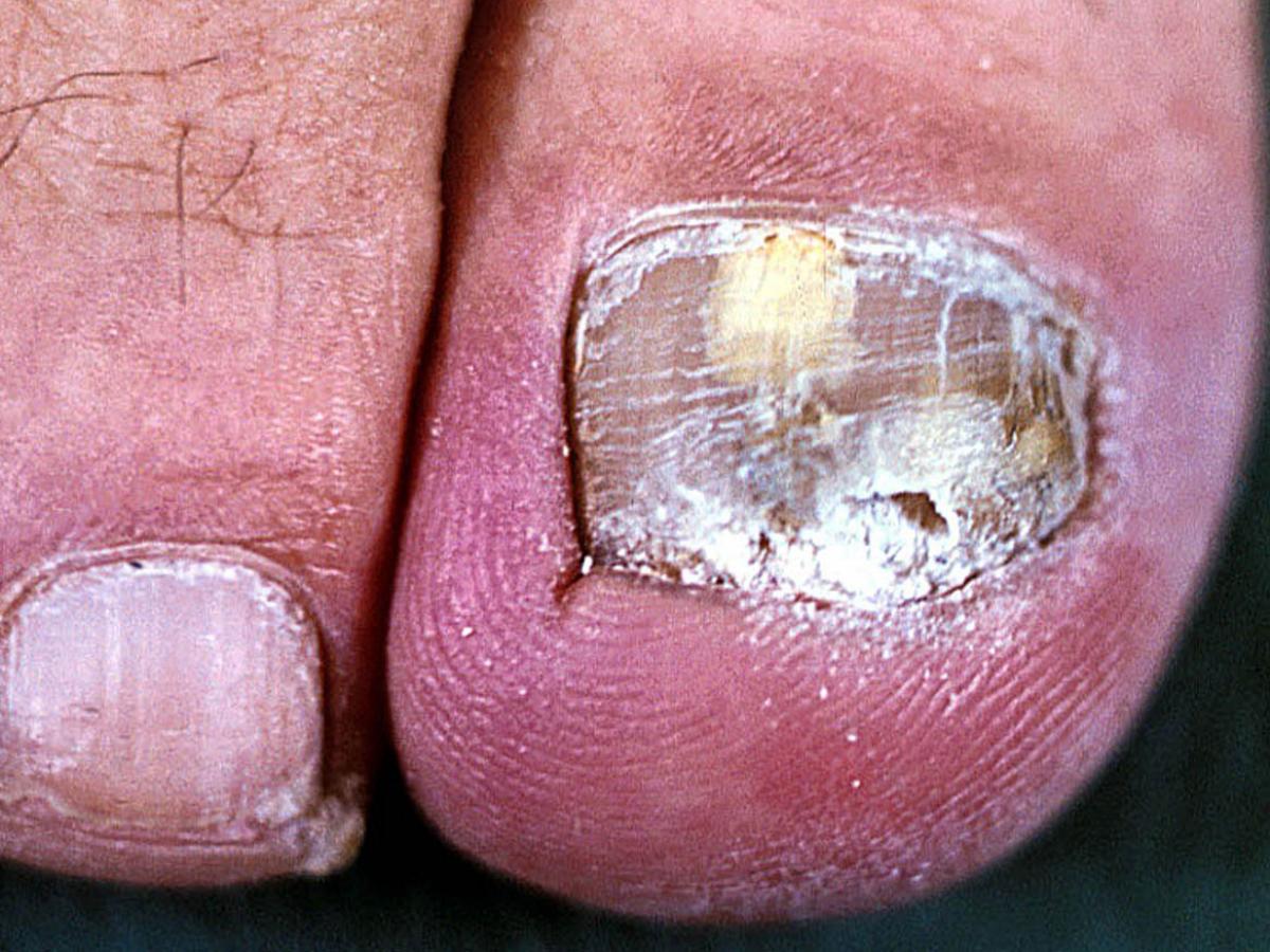 Clinical presentation