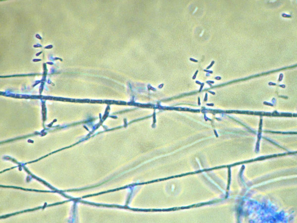 Microscopy