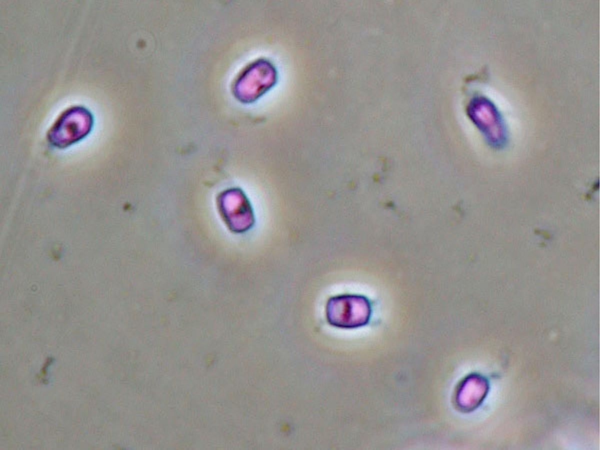 Unknown 05 microscopy - 1