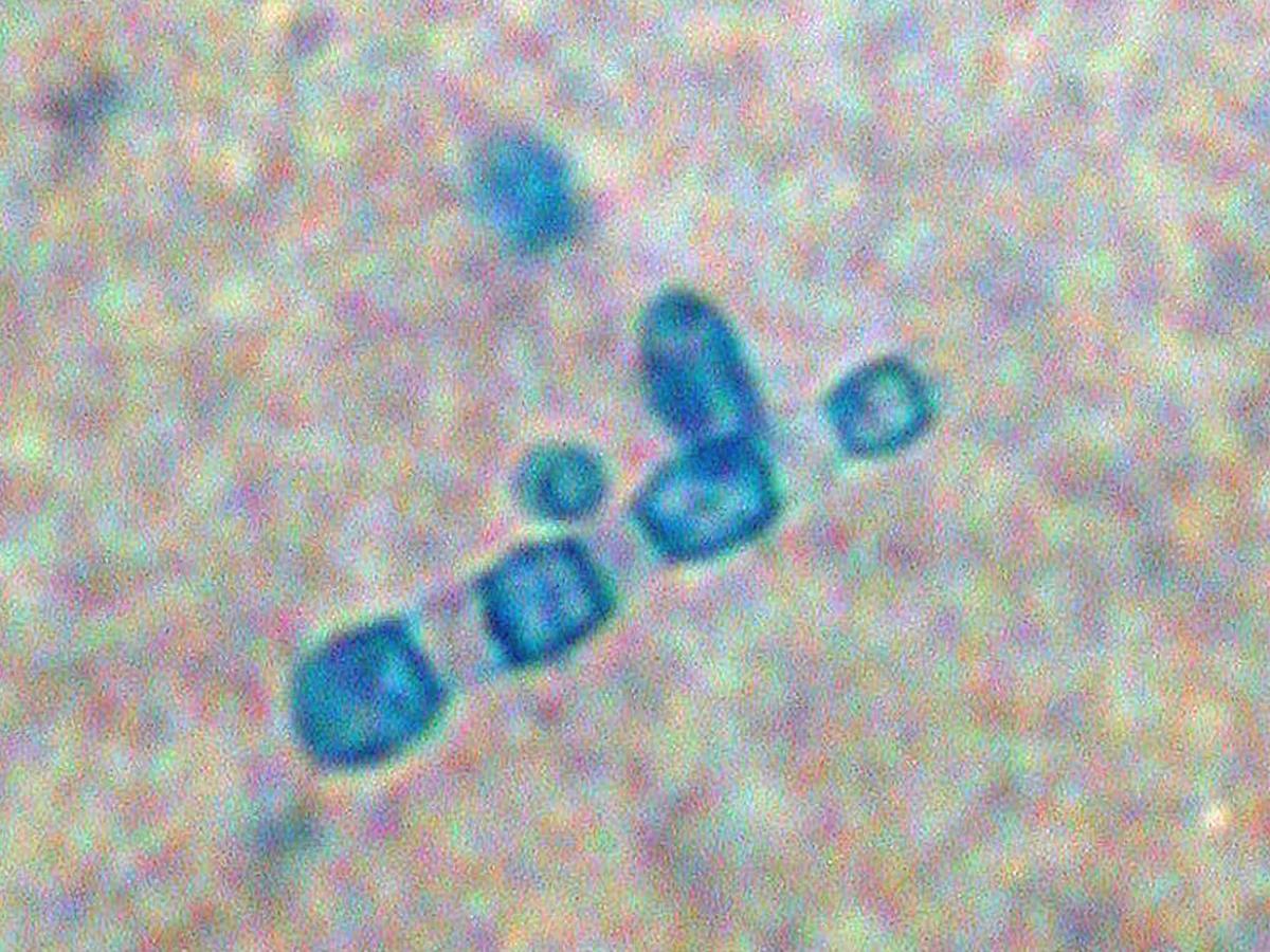 Unknown 05 microscopy - 2