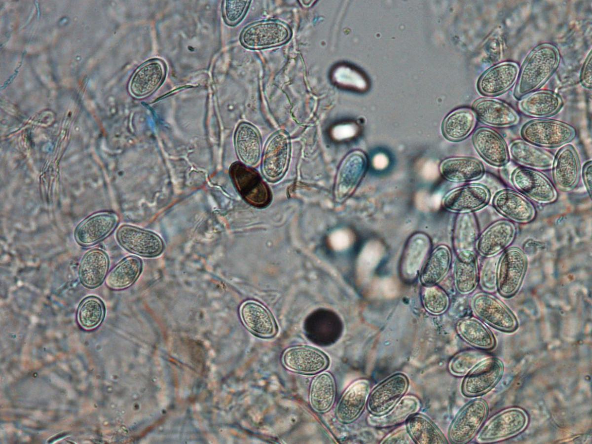 Unknown 52 microscopy - 2