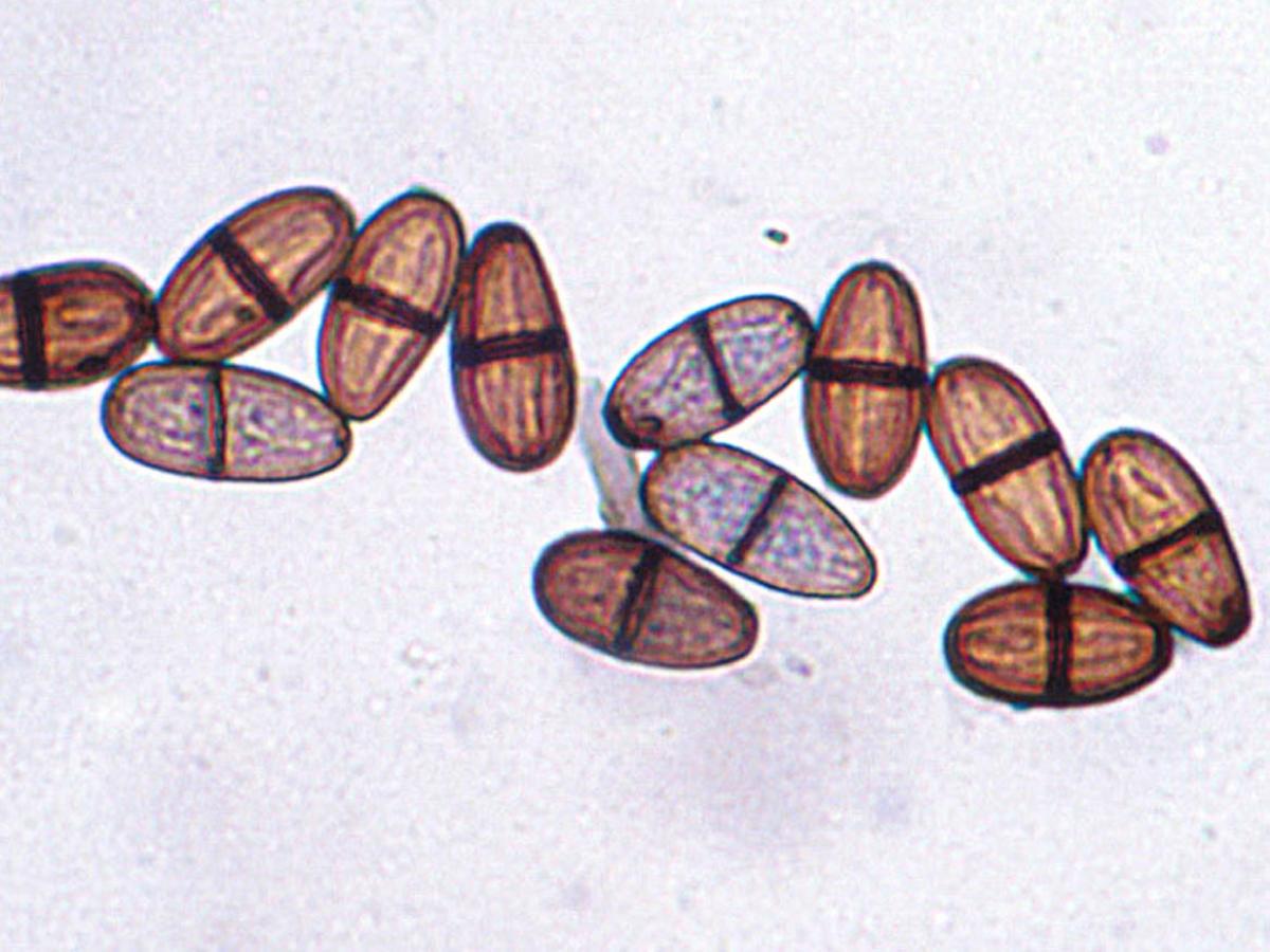 Unknown 52 microscopy - 3