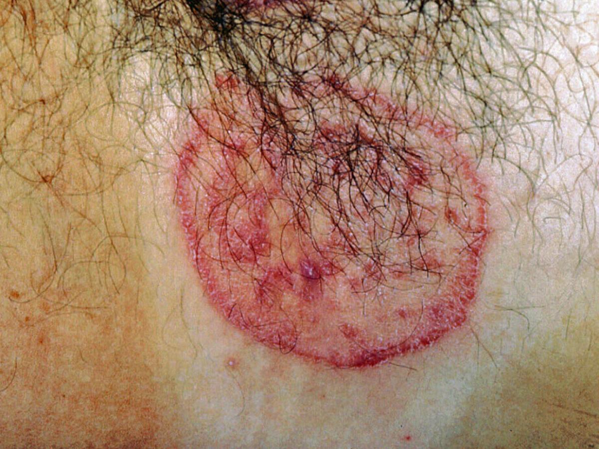 Unknown 54 clinical presentation