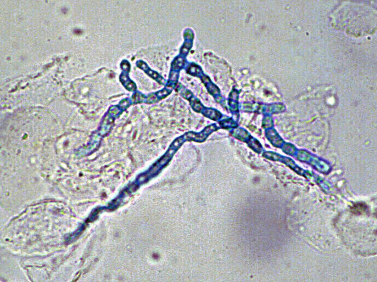 Unknown 54 direct microscopy (KOH mount)