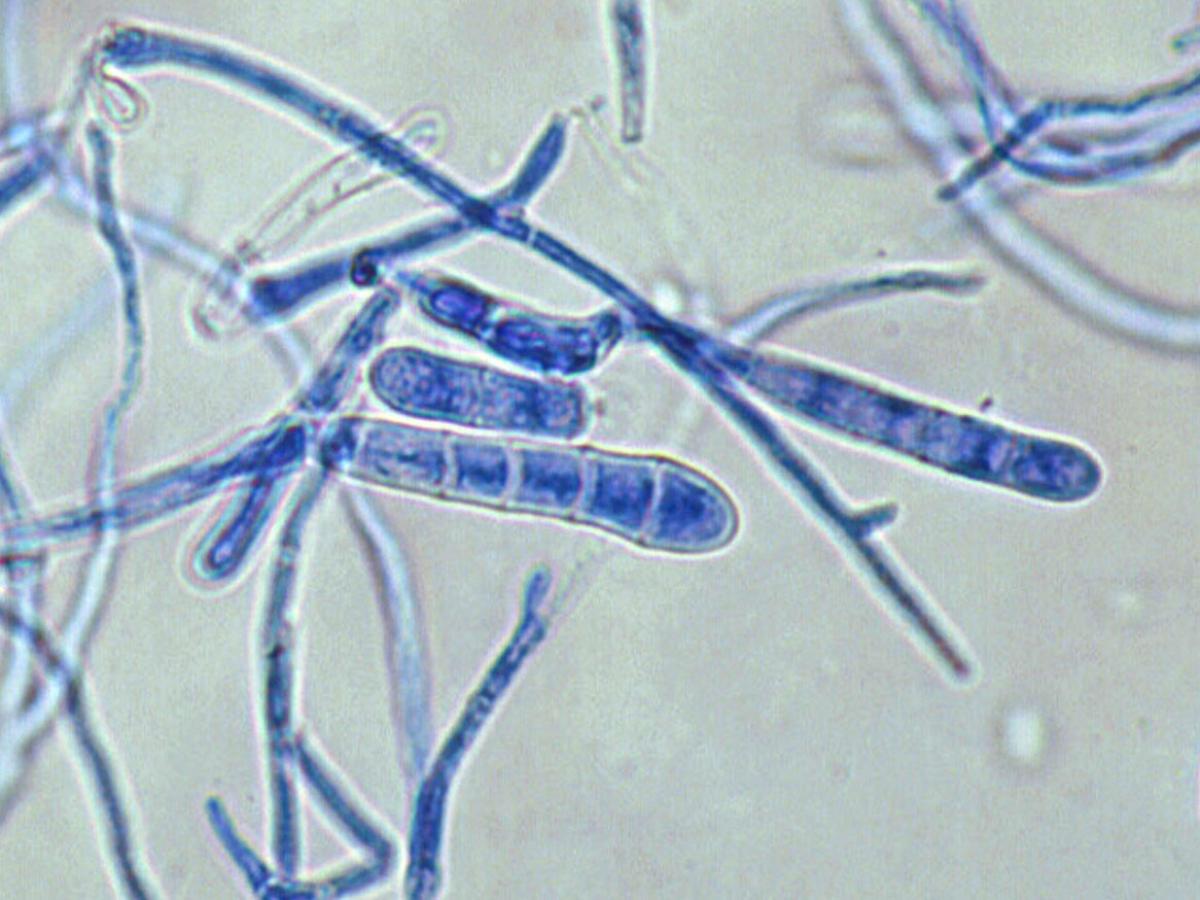 Unknown 54 microscopy - 1