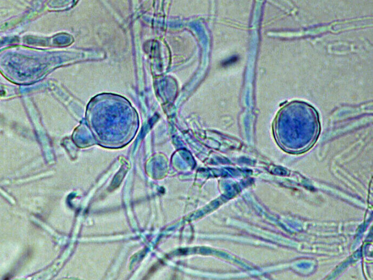 Unknown 54 microscopy - 2