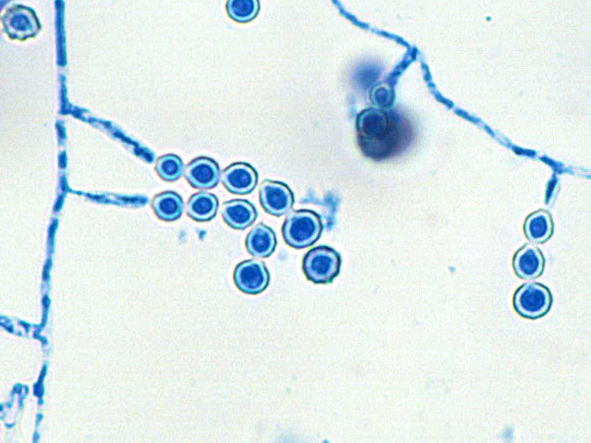 Unknown 56 microscopy - 1