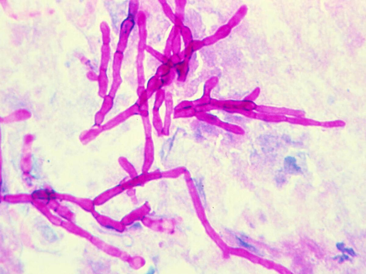 Unknown 60 clinical presentation