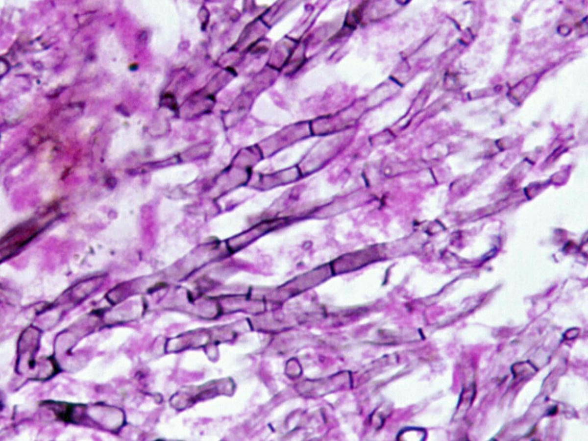 Unknown 07 Direct microscopy (methenamine silver stain)