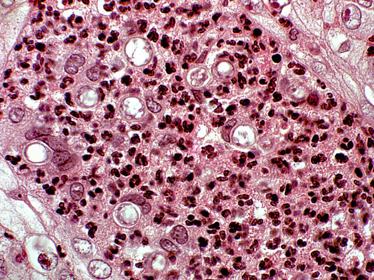 Direct microscopy (H&E staining)