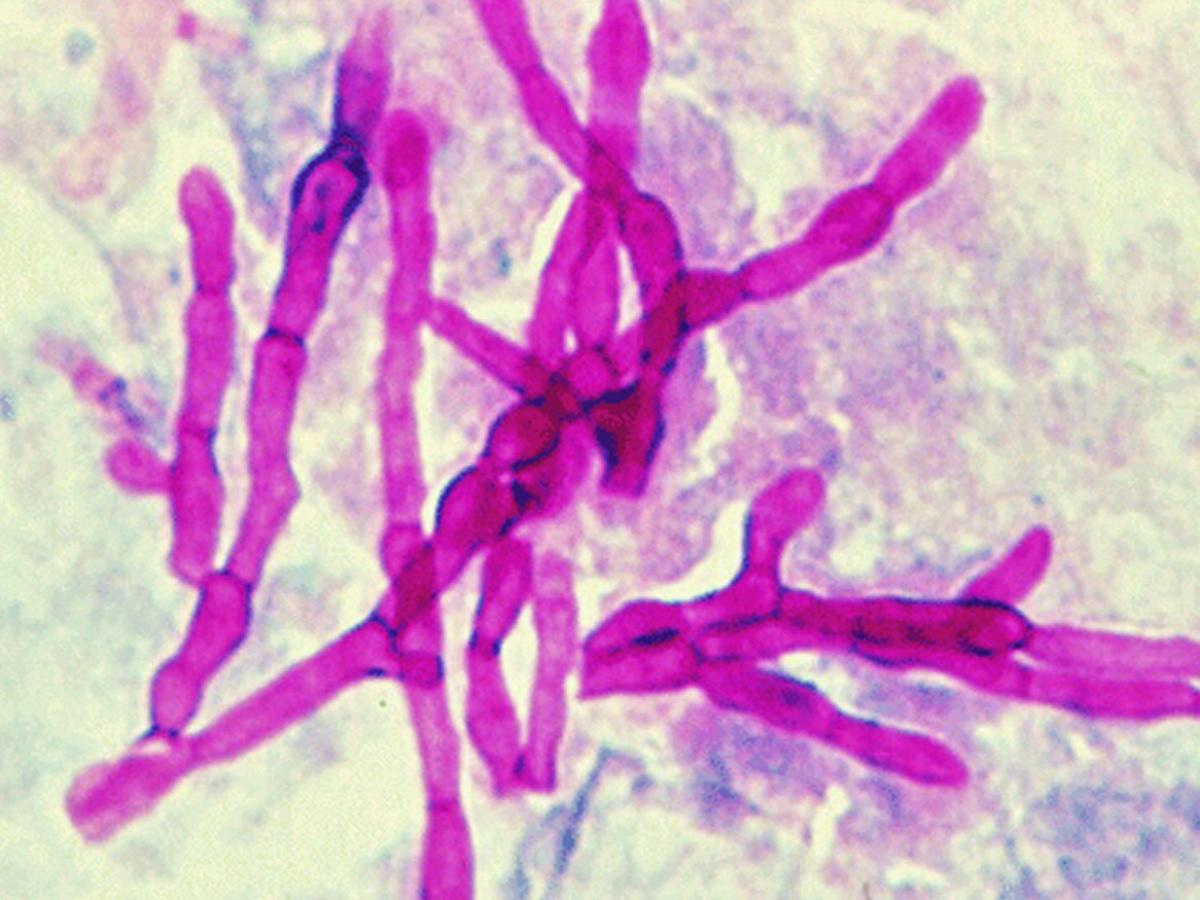 Direct microscopy (PAS staining)