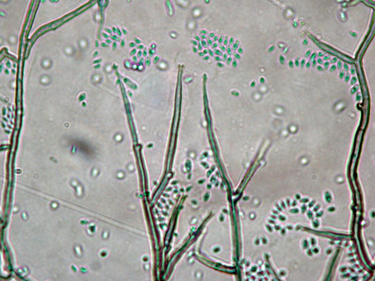 Unknown 09 microscopy - 1