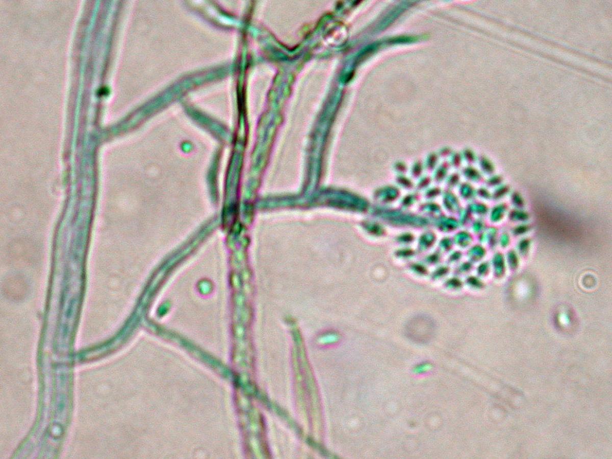 Unknown 09 microscopy - 2