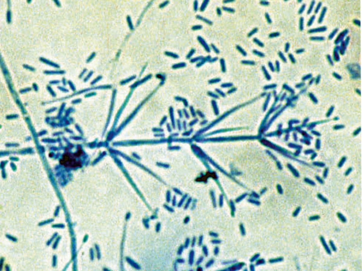 Verticillium
