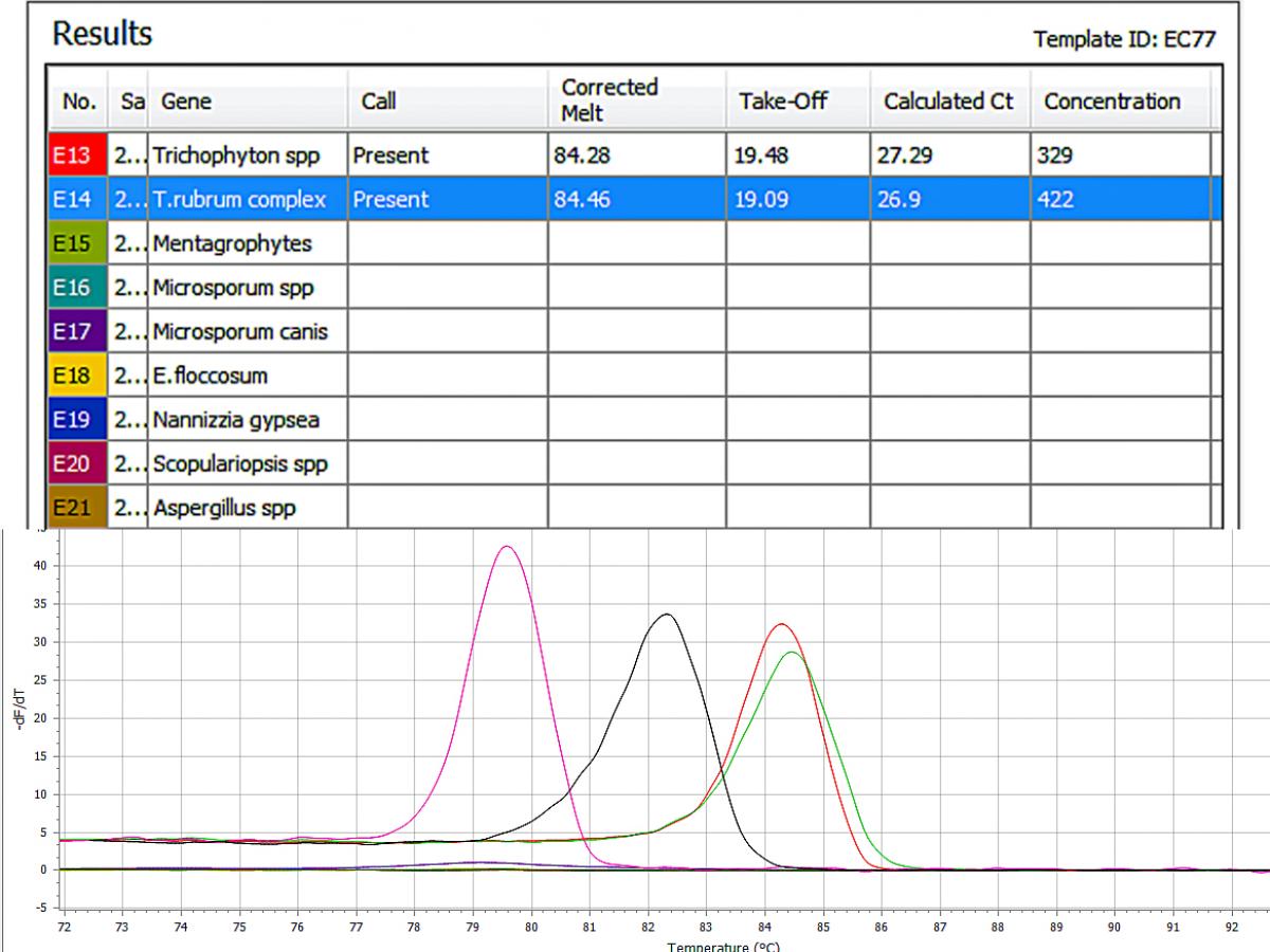 PCR for direct detection of T. rubrum