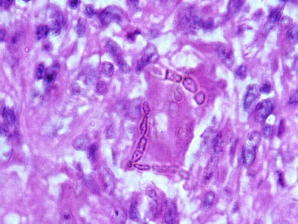 Histopathology