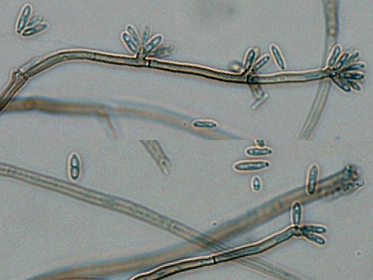 Microscopy