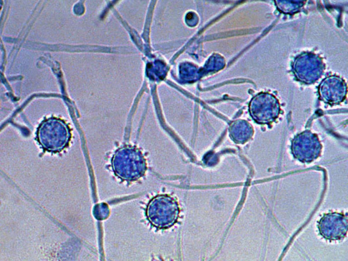 Unknown 71 microscopy