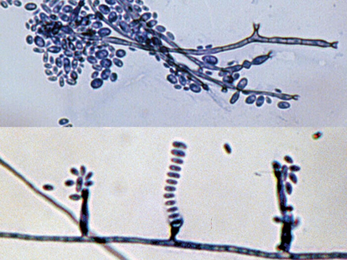 Unknown 74 microscopy