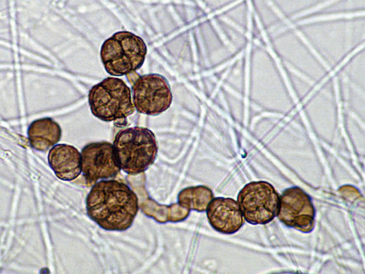 Unknown 75 microscopy