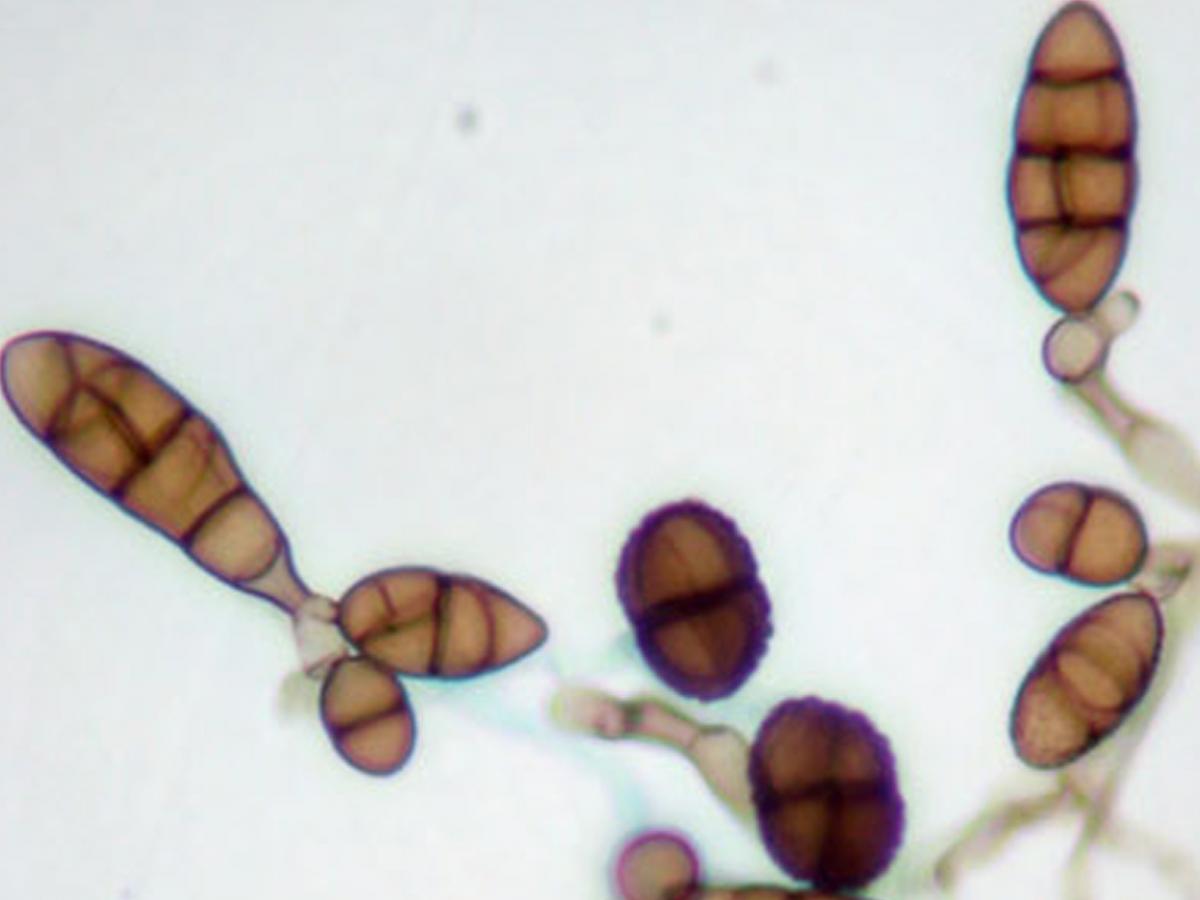 Unknown 76 microscopy - 1
