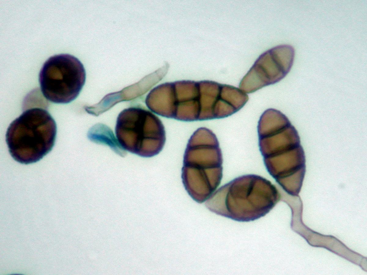 Unknown 76 microscopy - 2