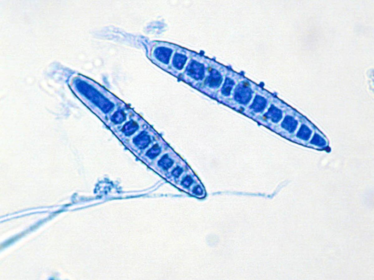 Unknown 77 microscopy